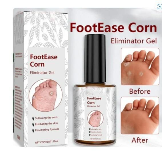 Pain-Free Foot Corn Remover Serum – Fast Action Formula for Corns, Calluses & Cracked Heels