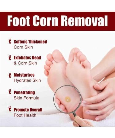 Pain-Free Foot Corn Remover Serum – Fast Action Formula for Corns, Calluses & Cracked Heels