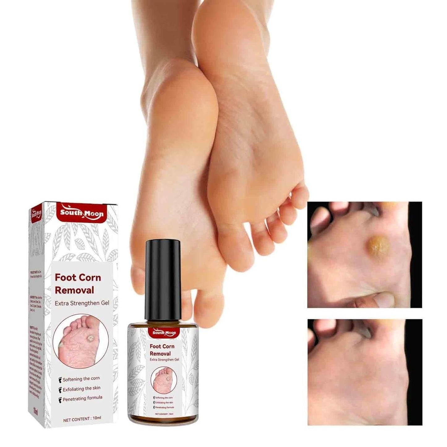 Pain-Free Foot Corn Remover Serum – Fast Action Formula for Corns, Calluses & Cracked Heels